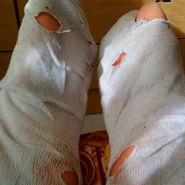 Archivo:Patas.png